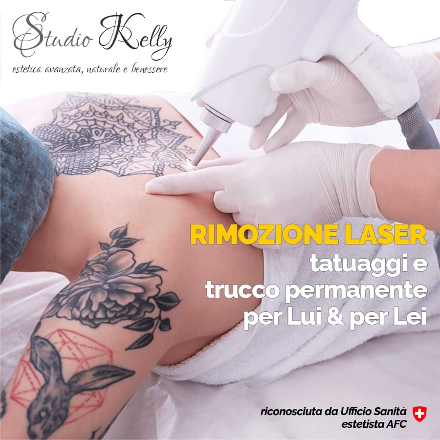 Offerta Laser Tattoo Removal - Studio Kelly